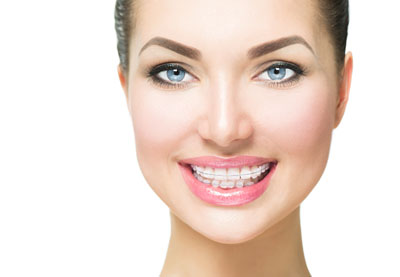 The Benefits Of Clear Braces In Forest Hills And Invisalign