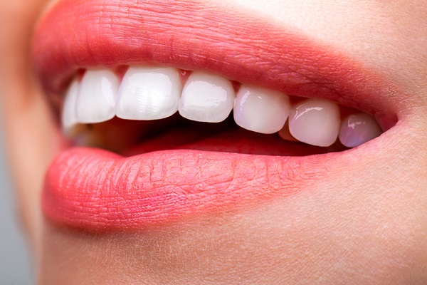 A General Dentist Can Use Bonding To Repair Teeth