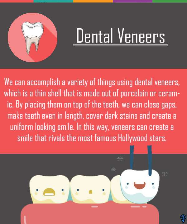 Dental Veneers and Dental Laminates Forest Hills, NY