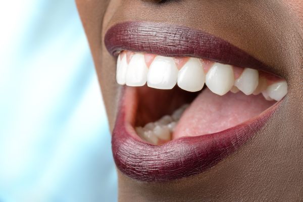 Full Mouth Reconstruction: Dental Crowns To Improve Oral Health