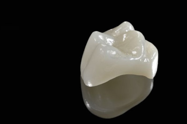 Dental Crown Uses With A Same Day Dentist