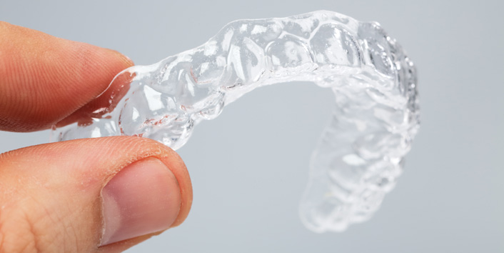 Can Anyone Get Clear Braces? - Metro Smiles Dental Forest Hills New York
